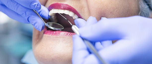 Best Chipped Tooth Repair Near Me  in Big Timber, MT